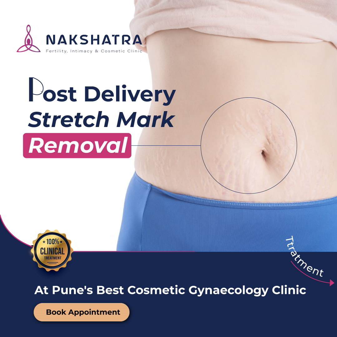 post delivery stretch marks