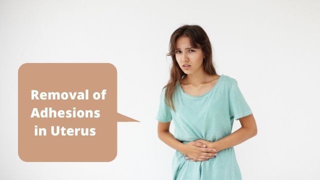 Removal of Adhesions in Uterus